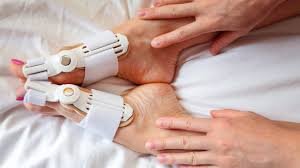 Do Bunion Correctors Work