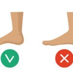 How to Get Rid of Cankles: