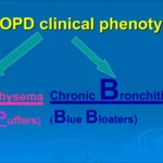 Pink Puffer vs Blue Bloater: Understanding the Differences