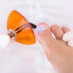 Рodologist (podiatrist) in gloves puts a titanium thread on a toenail with special polymerization