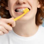 Why Are My Teeth Yellow After Braces: Causes, Solutions, and Expert Tips for a Bright Smile